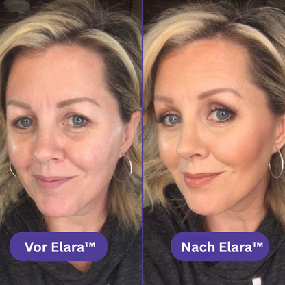 Elara™ Microneedling-Infusionsset